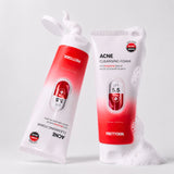Acne Cleansing Foam