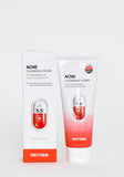 Acne Cleansing Foam
